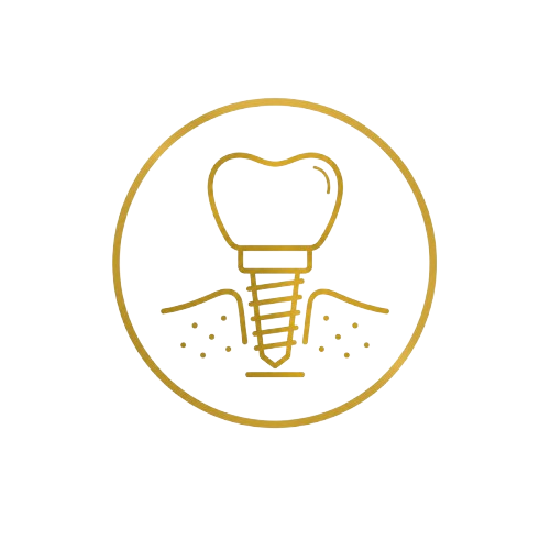 Implantes Dentales